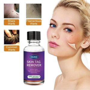 Skin Tag Remover